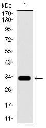 Monoclonal Mouse anti-Human SLC27A5 / BACS Antibody (clone 9C4D1, aa508-570, IHC, WB)