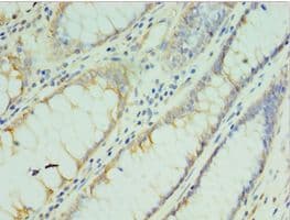 TMOD3 / Tropomodulin 3 Antibody (aa1-352)