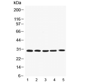 Polyclonal Rabbit anti-Human BCL2L1 / BCL-XL Antibody (IHC, WB)