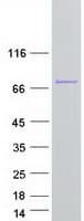 Human EXOSC9 / p5 Protein (Recombinant Myc-DDK (Flag))