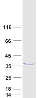 Human ABHD12B Protein (Recombinant Myc-DDK (Flag))