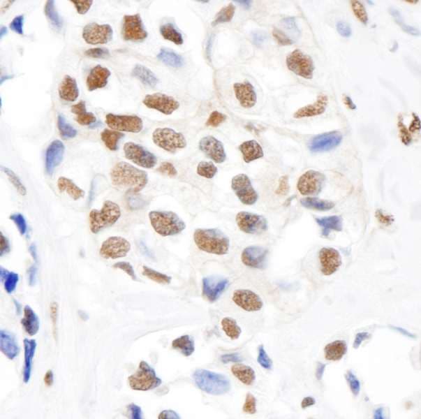 Polyclonal Rabbit anti-Human SMC1A / SMC1 Antibody (phospho-Ser966, IHC, IF, WB)