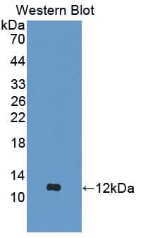 ACAN / Aggrecan Antibody (aa587-684, APC)