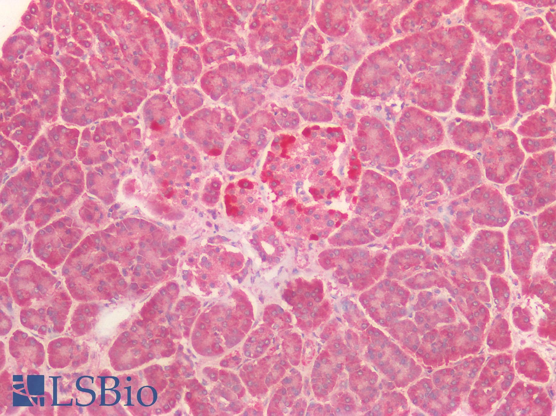 VPS4A Antibody