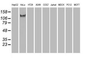 Monoclonal Mouse anti-Human L1CAM Antibody (clone OTI10C12, IHC, WB)