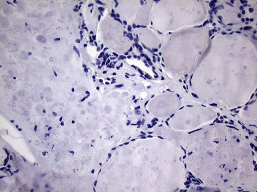 GLOD2 / MCEE Antibody (clone OTI3B11, Carrier-free)