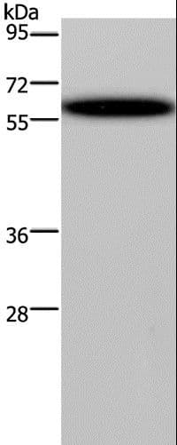 DDX19B Antibody