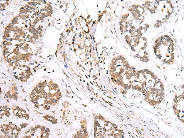 BAG2 Antibody