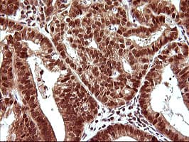 UPRT Antibody (clone OTI2F2)