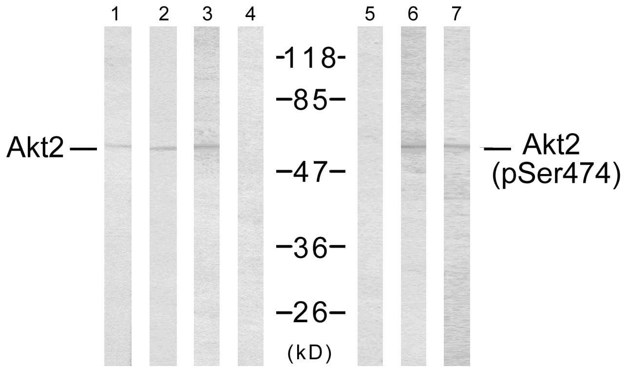 AKT2 Antibody (phospho-Ser474)