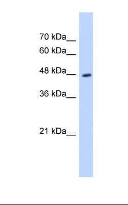 Polyclonal Rabbit anti-Human HADHB Antibody (aa351-400, IHC, WB)
