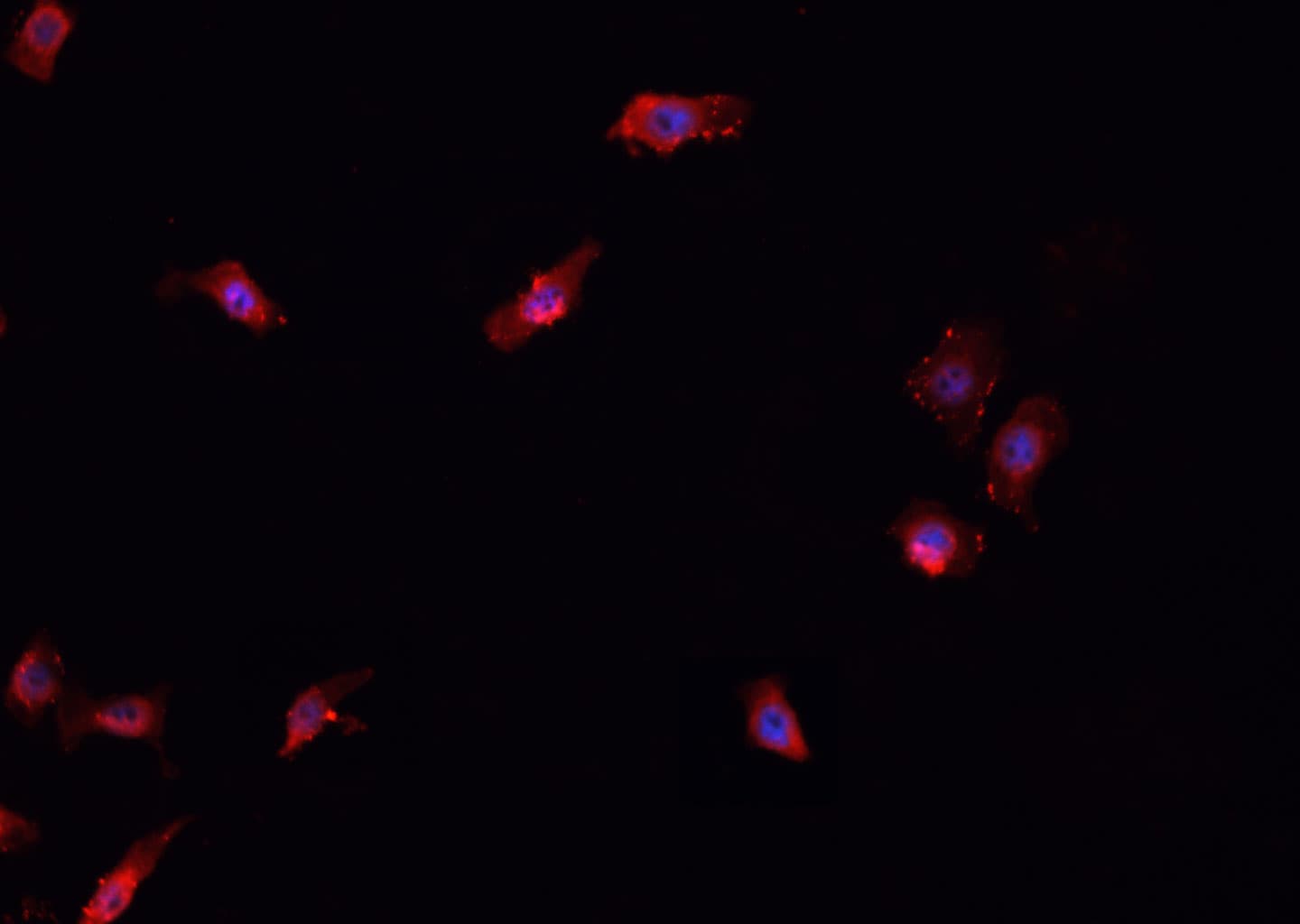 TBX1 Antibody
