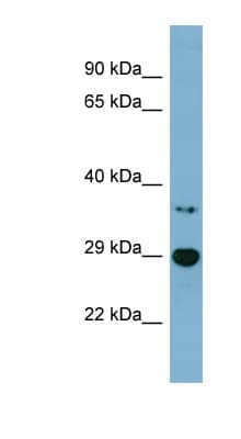 BDH2 Antibody (aa143-192)