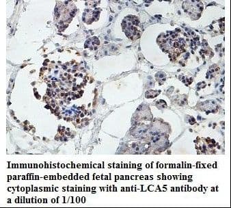 LCA5 Antibody (aa37-222)