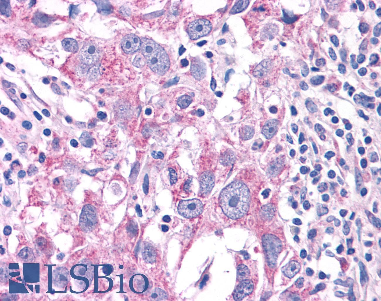 PathPlus™ NEK6 Antibody (N-Terminus)
