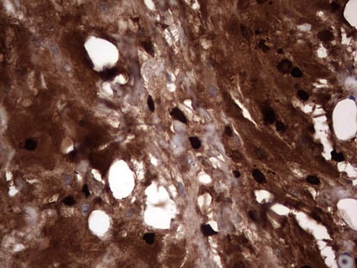 S100A9 / MRP14 Antibody (clone OTI8C2)