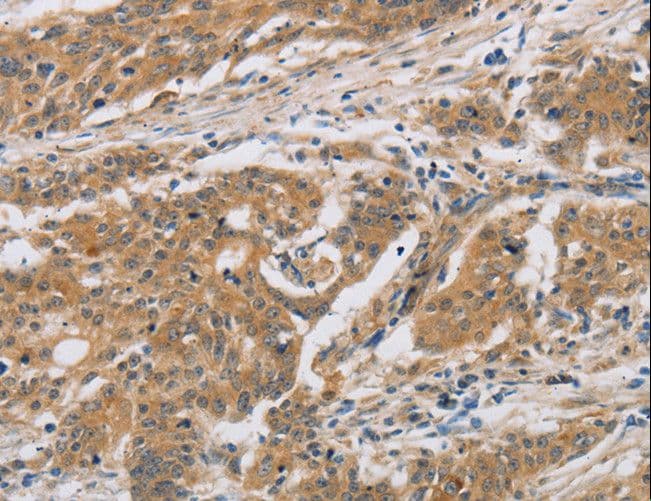 CST6 / Cystatin E/M Antibody
