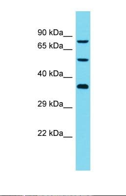 DCAF8L2 Antibody (aa537-586)