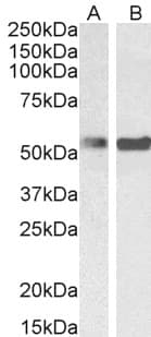 IHC-plus™ PTBP1 Antibody (aa2-14)