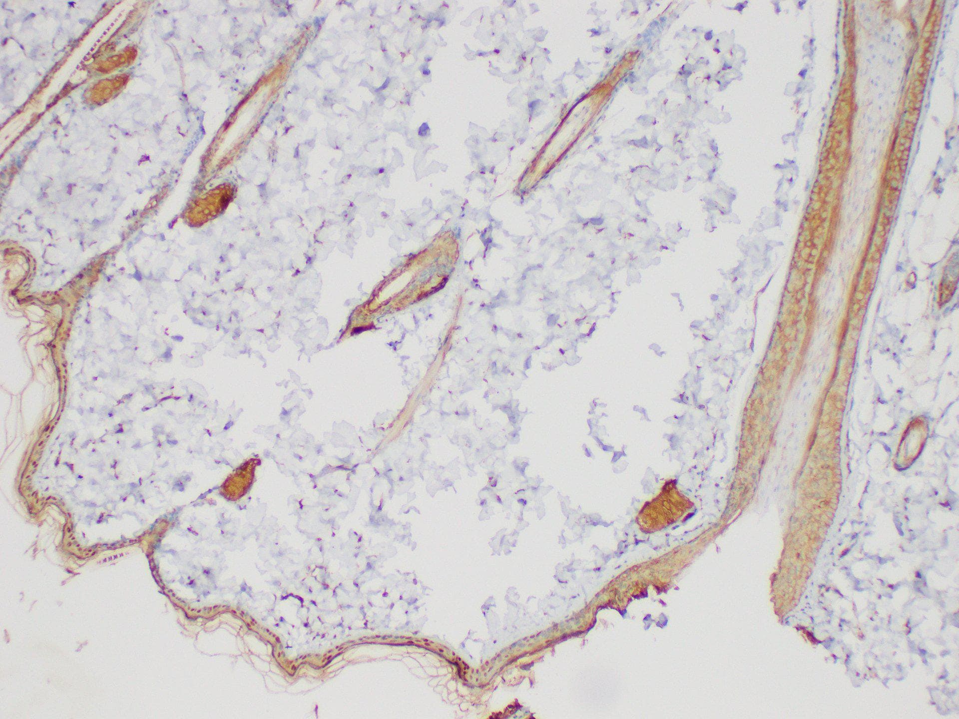SERPINB2 / PAI-2 Antibody