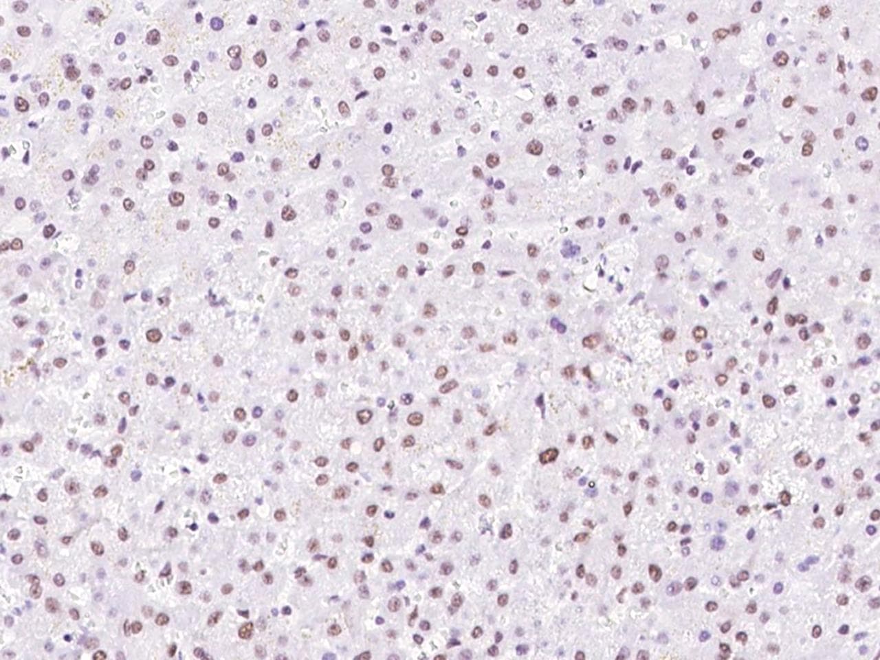 SNRPD2 Antibody