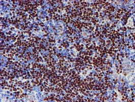 MEF2C Antibody (clone OTI2F2)