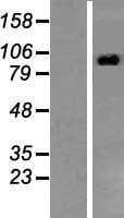 STAT2 Protein (Over-Expression Lysate Myc-DDK (Flag))