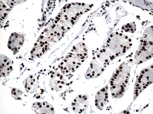 GTF3C4 Antibody (aa583-822, clone OTI4A1)