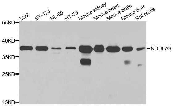 Polyclonal Rabbit anti-Human NDUFA9 Antibody (WB)