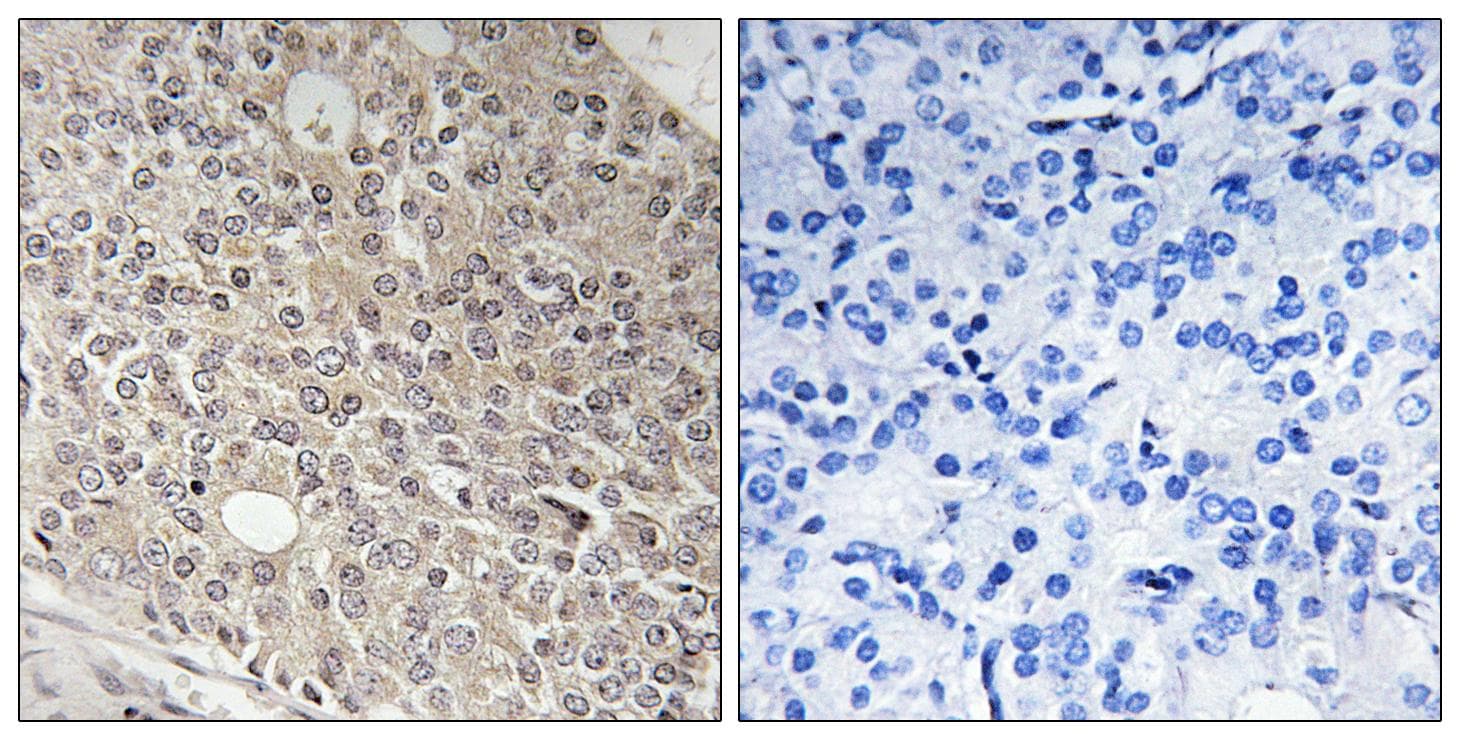 JEAP / AMOTL1 Antibody