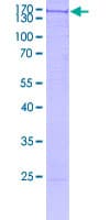 Human Trimethylguanosine Synthase 1 Protein (Recombinant GST)