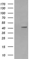 MAP2K1 / MKK1 / MEK1 Antibody (clone OTI2F12)