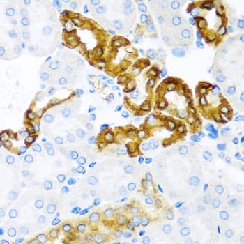 CST1 / Cystatin SN Antibody