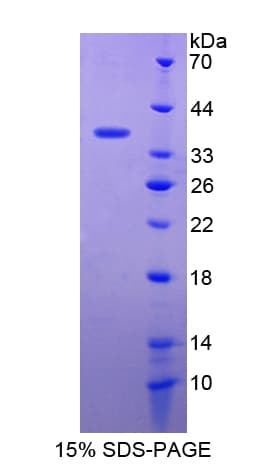 Human c-Met Protein (Recombinant His-T7)