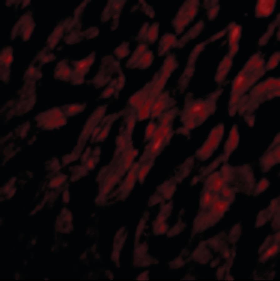 Polyclonal Rabbit anti-Human GPR44 / CRTH2 Antibody (IHC, IF, WB)