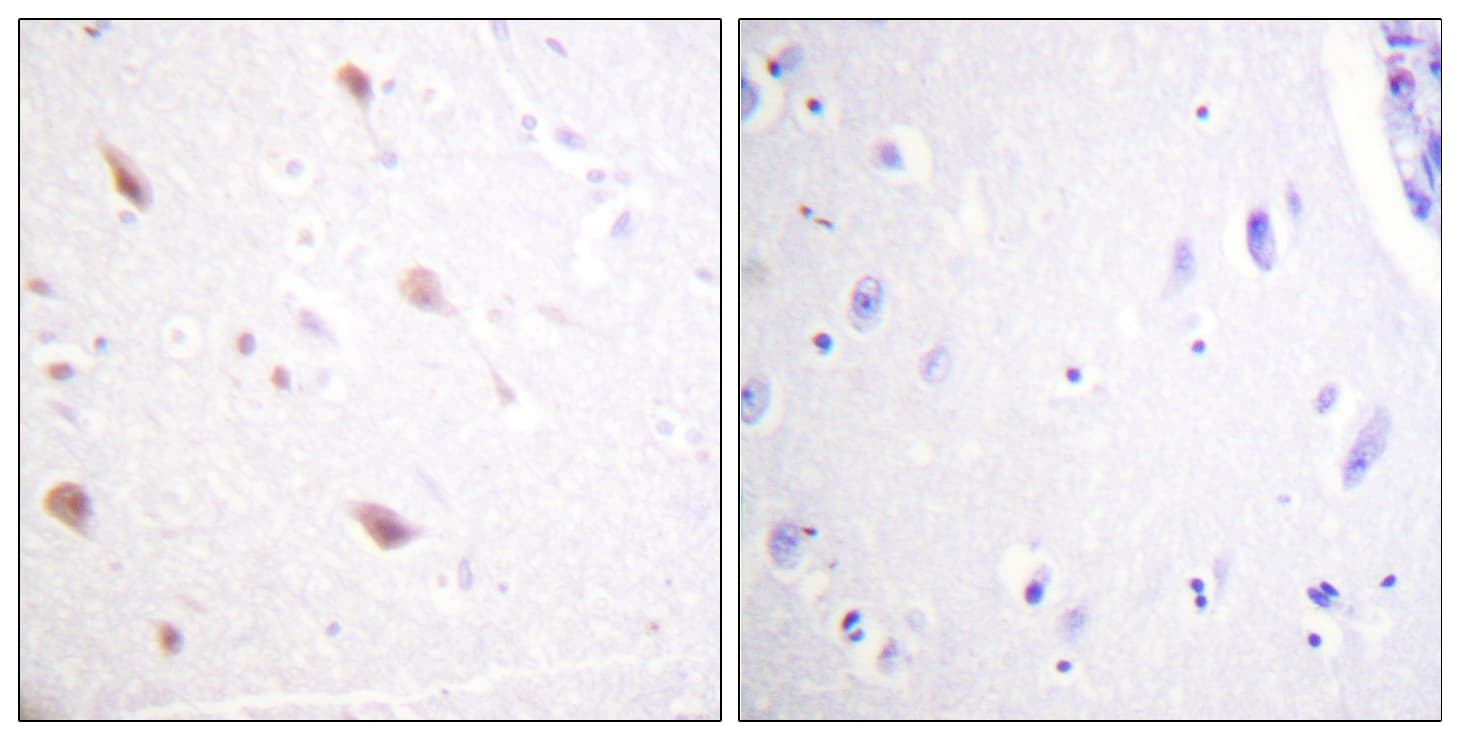 NIFK / MKI67IP Antibody (phospho-Thr234)