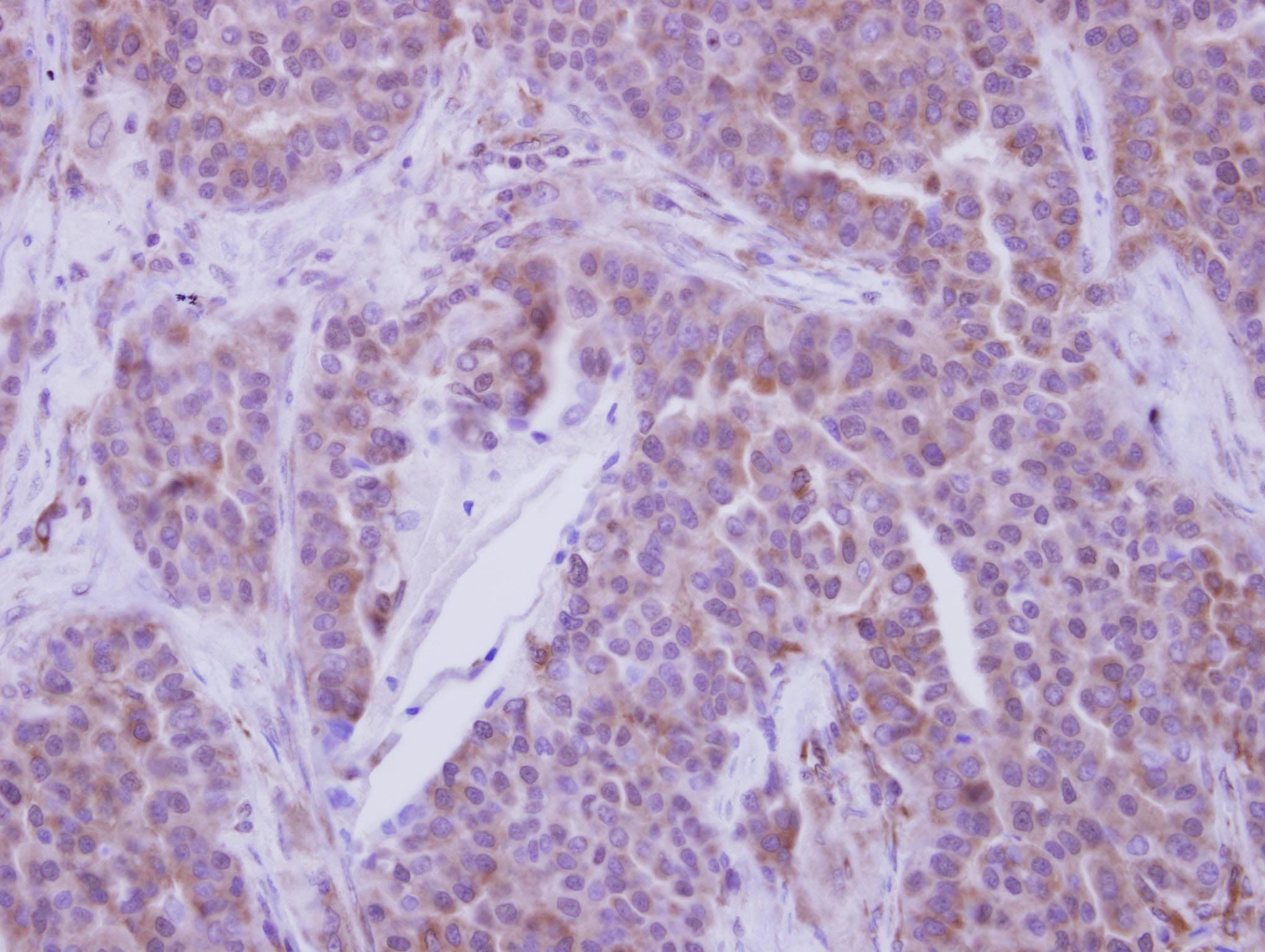 IHC-plus™ MSY2 / YBX2 Antibody (Internal)