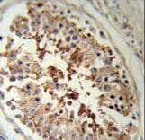 SERPINH1 / HSP47 Antibody (aa169-196)