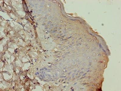 Polyclonal Rabbit anti-Human ATP12A Antibody (aa171-306, IHC)