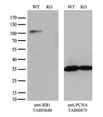 RB1 / Retinoblastoma / RB Antibody (aa309-590, clone OTI13A6)
