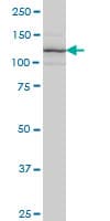 IHC-plus™ ITGA7 / Integrin Alpha 7 Antibody (clone 8G2)