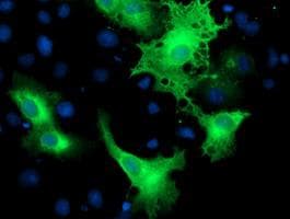 ERBB2 / HER2 Antibody (aa676-1255, clone OTI4F10, Carrier-free)