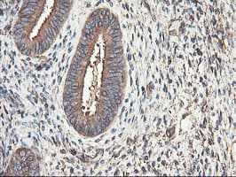 TUBAL3 Antibody (clone OTI1C2)