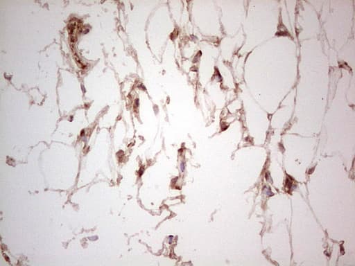 UBE2D2 / UBCH5B Antibody (clone OTI2C2, Carrier-free)