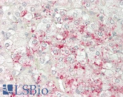 PPP6R3 / SAPS3 Antibody