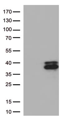 PRG2 / Proteoglycan 2 Antibody (aa17-222, clone OTI2F11)