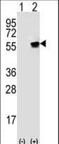 VRK1 Antibody (aa366-396)