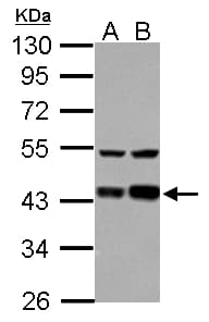 IHC-plus™ Polyclonal Rabbit anti-Human LRPAP1 Antibody (IHC, WB)