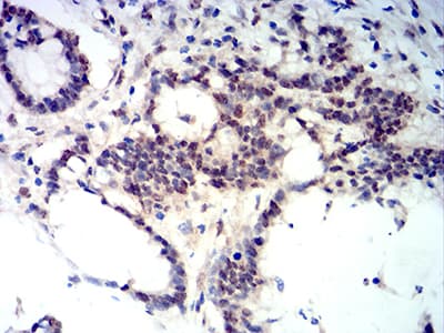 BCL11B Antibody (clone 1F8G8)