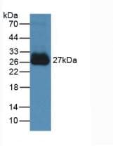 Mouse IL6 / Interleukin 6 Protein (Recombinant His, N-Terminal)